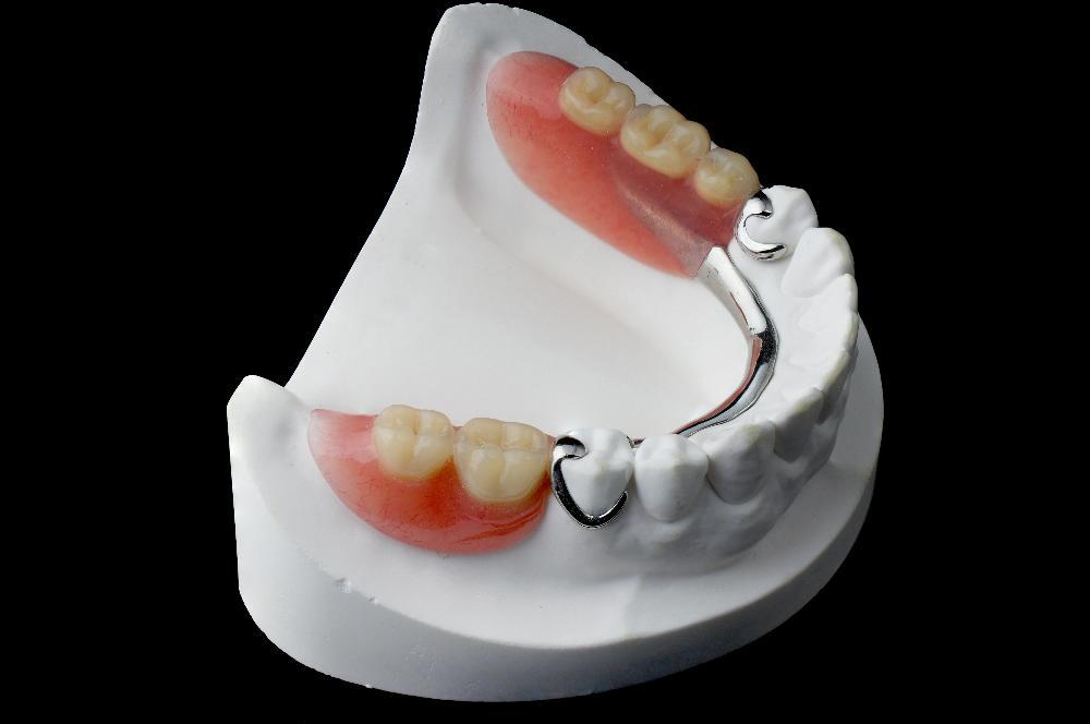 Custom partial denture at dentist office in Belcaro CO