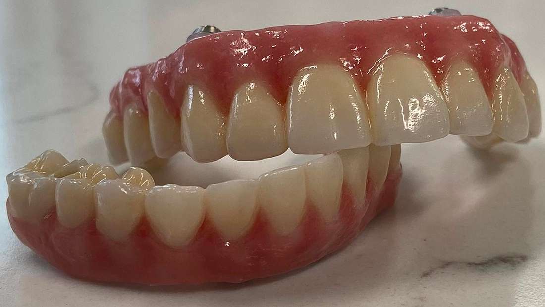 Are Hybrid Dentures Right for You? Full & Partial Dentures Denver CO