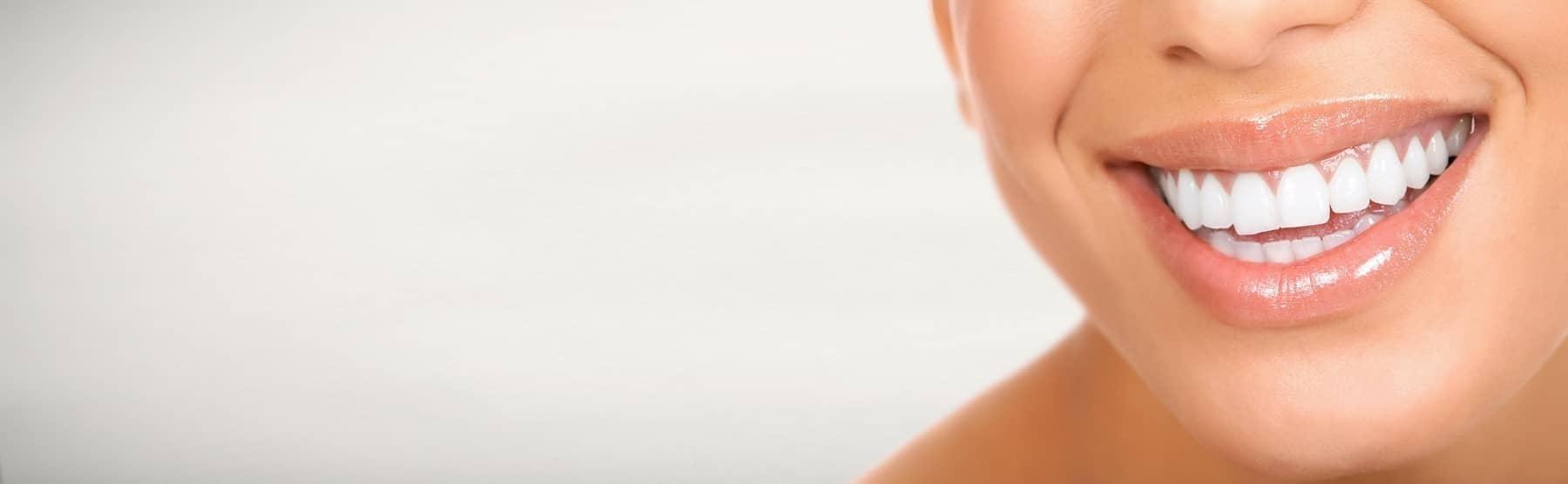 Close up of patients smile after cosmetic dentistry in Denver CO